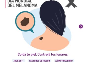 23 DE MAYO / DÍA MUNDIAL DEL MELANOMA:: Cuidá tu piel. Controlá tus lunares