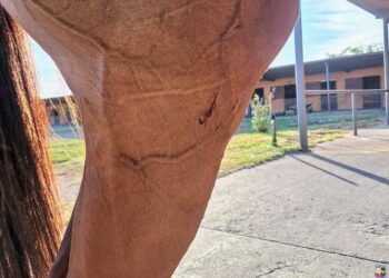 Un perro raza pitbull atacó a dos equinos de la División Caballería Montada y como consecuencia una oficial de policía también resultó lastimada