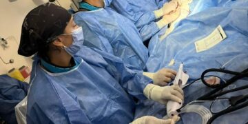 Realizaron por primera vez un procedimiento para tratar lesiones en las arterias coronarias