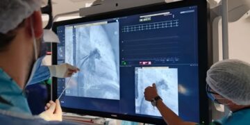 Realizaron a dos pacientes un procedimiento cardiológico inédito en el Hospital ‘Ramón Carrillo’