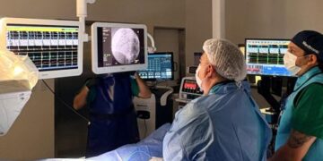 Realizaron por primera vez una crioablación cardíaca en el Hospital Carrillo