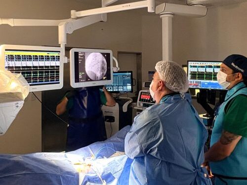 Realizaron por primera vez una crioablación cardíaca en el Hospital Carrillo